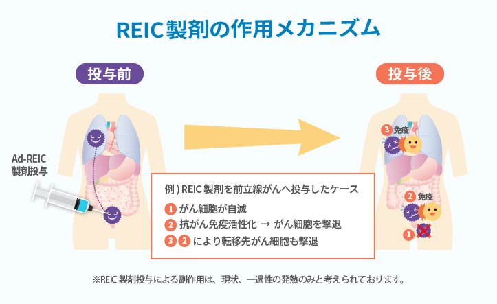 REIC製剤の作用メカニズム