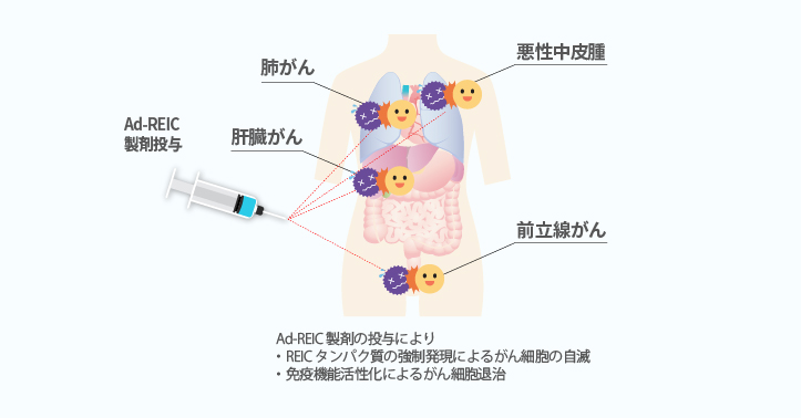 REIC製剤の作用メカニズム