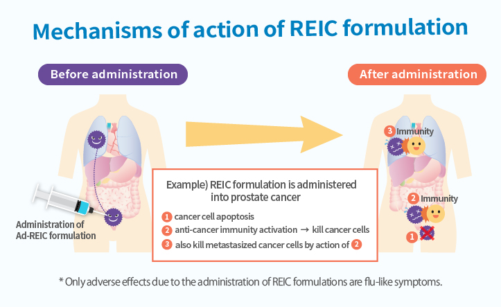 Immunotherapy of cancer by gene therapy Development of a next-generation cancer drug